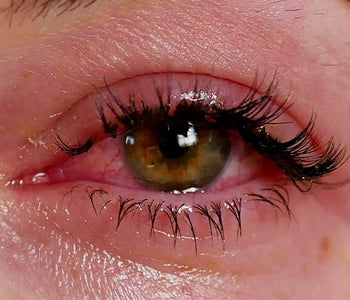 How to Combat Eyelash Extension Glue Allergy
